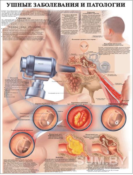 Травмы и болезни организма. Плакаты для медицинского колледжа объявление Услуга уменьшенное изображение 
