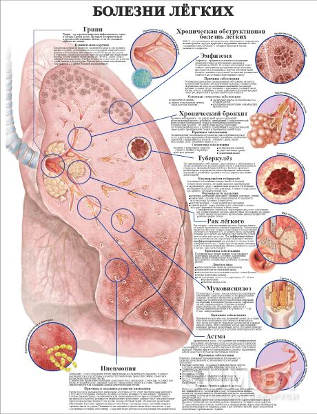 Травмы и болезни организма. Плакаты для медицинского колледжа объявление Услуга уменьшенное изображение 
