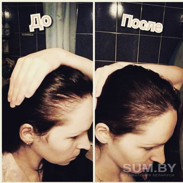 Сыворотка против выпадения волос объявление Продам уменьшенное изображение 